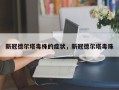 新冠德尔塔毒株的症状，新冠德尔塔毒珠